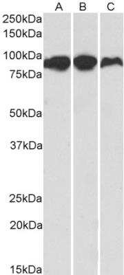 Western Blot: Aconitase 2 Antibody [NBP1-52015]