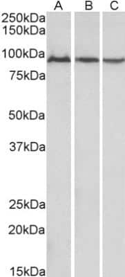 Western Blot: Aconitase 2 Antibody [NBP1-52015]