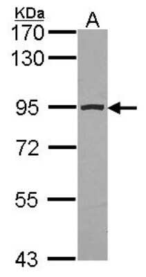 Western Blot: Aconitase 2 Antibody [NBP2-15245]