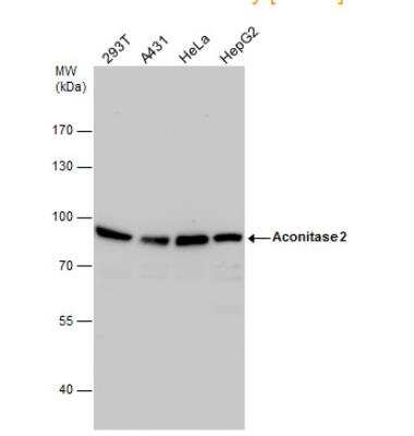 Western Blot: Aconitase 2 Antibody [NBP2-15245]