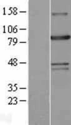 Western Blot: Aconitase 2 Overexpression Lysate [NBL1-07244]