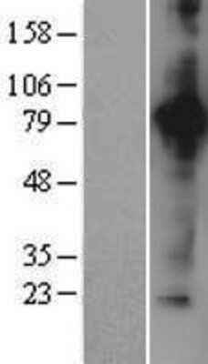 Western Blot: Aconitase 2 Overexpression Lysate [NBL1-07244]