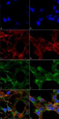 Immunocytochemistry/ Immunofluorescence: Acrolein Antibody (10A10) [NBP2-59359]