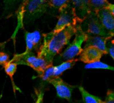 Immunocytochemistry/ Immunofluorescence: Acrolein Antibody (2H2) [NBP2-59358]