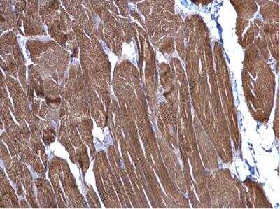 Immunohistochemistry-Paraffin: Actin Alpha 1 Cardiac Muscle Antibody [NBP1-33759]