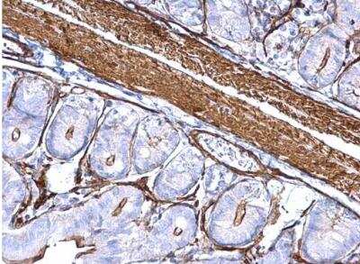 Immunohistochemistry-Paraffin: Actin Alpha 1 Cardiac Muscle Antibody [NBP1-33759]