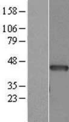 Western Blot: Actin Alpha 1 Cardiac Muscle Overexpression Lysate [NBL1-07273]