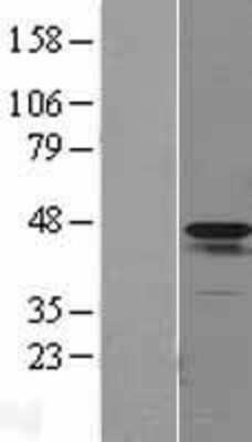 Western Blot: alpha-Smooth Muscle Actin Overexpression Lysate [NBL1-07272]