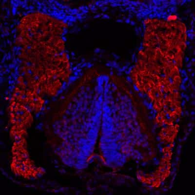 Immunocytochemistry/ Immunofluorescence: Actin Alpha 1 Cardiac Muscle Antibody (22D3) - BSA Free [NBP1-97725]