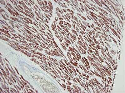 Immunohistochemistry-Paraffin: Actin Alpha 1 Cardiac Muscle Antibody (22D3) - BSA Free [NBP1-97725]