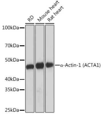 Western Blot: Actin Antibody (3U6B8) [NBP3-16100]