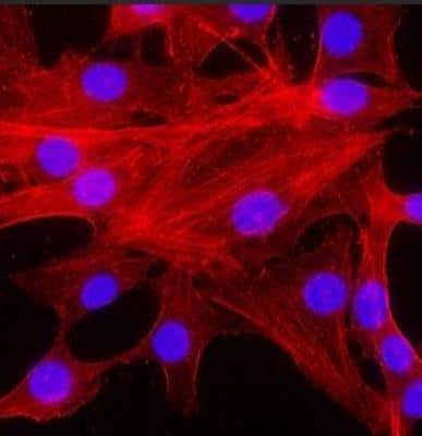 Immunocytochemistry/ Immunofluorescence: pan Actin Antibody (5J11) [NBP2-25142]