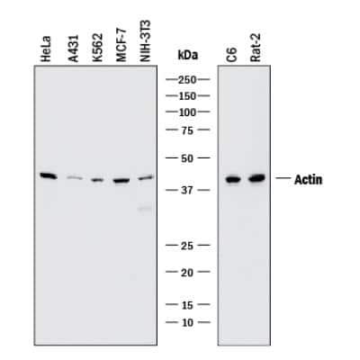 Western Blot: pan Actin Antibody (5J11) [NBP2-25142]