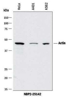 Western Blot: pan Actin Antibody (5J11) [NBP2-25142]