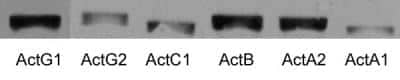 Western Blot: pan Actin Antibody (5J11) [NBP2-25142]