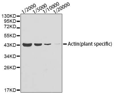 Western Blot: Actin Antibody (9Y9L6) [NBP3-16885]
