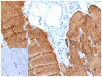 Immunohistochemistry-Paraffin: Actin Antibody (ACTA1/360) [NBP3-13759]