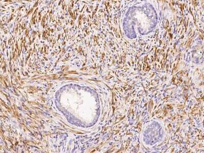 Immunohistochemistry-Paraffin: Actin Antibody [NBP2-98923]