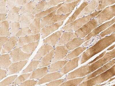 Immunohistochemistry-Paraffin: Actin Antibody [NBP2-98923]