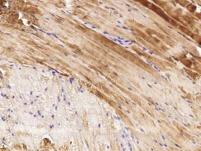 Immunohistochemistry-Paraffin: Actin Antibody [NBP2-98923]