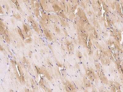 Immunohistochemistry-Paraffin: Actin Antibody [NBP2-98923]