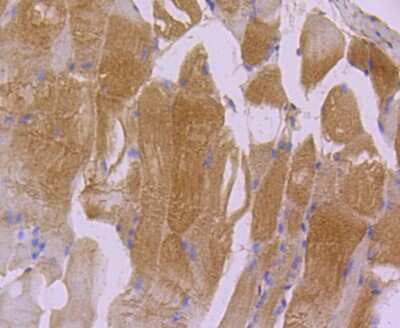 Immunohistochemistry-Paraffin: Actin Antibody (JJ09-29) [NBP2-67907]