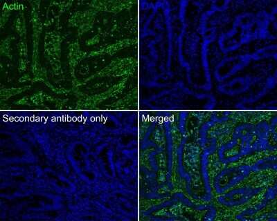 Immunohistochemistry-Paraffin: Actin Antibody (JJ09-29) [NBP2-67907]