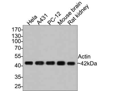 Western Blot: Actin Antibody (JJ09-29) [NBP2-67907]