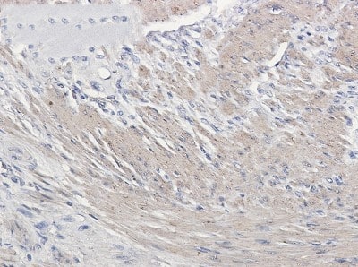Immunohistochemistry-Paraffin: Actin Antibody (S05-4F6) [NBP3-19993]