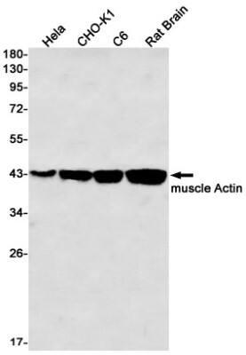 Western Blot: Actin Antibody (S05-4F6) [NBP3-19993]