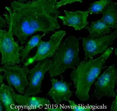 Immunocytochemistry/ Immunofluorescence: Actin Antibody (mAbGEa) - Azide and BSA Free [NBP2-80561]