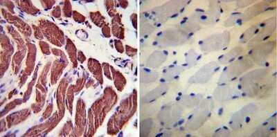 Immunohistochemistry: Actin Antibody (mAbGEa) - Azide and BSA Free [NBP2-80561]