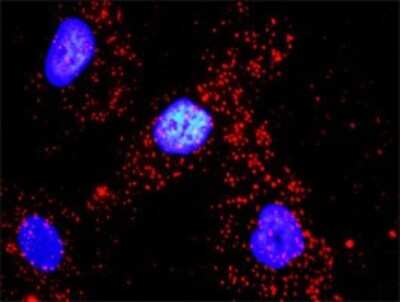 Proximity Ligation Assay: Actin Gamma 1 Antibody (1G6) [H00000071-M01]