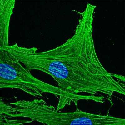 Immunocytochemistry/ Immunofluorescence: Actin Gamma 1 Antibody (2A3) - BSA Free [NBP1-97720]