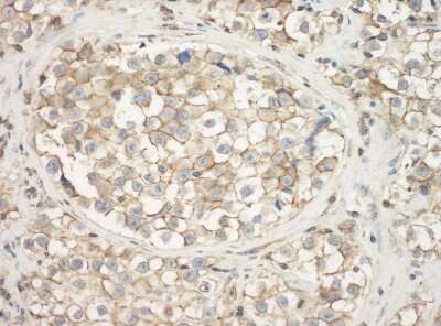 Immunohistochemistry: Actin Gamma 1 Antibody [NB600-533]