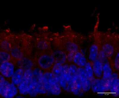 Immunohistochemistry-Paraffin: Actin Gamma 1 Antibody (NH3) [NB100-64792]