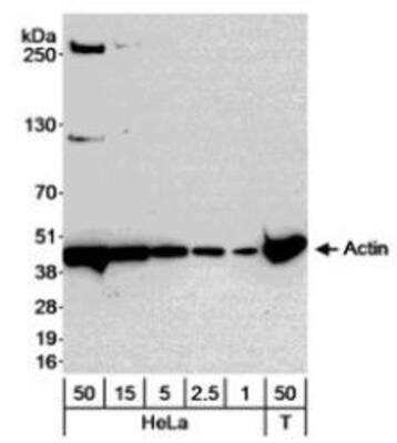 Western Blot: Actin Gamma 1 Antibody [NB600-533]