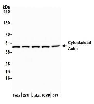 Western Blot: Actin Gamma 1 Antibody [NB600-533]