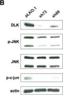 Western Blot: Actin Gamma 1 Antibody [NB600-533]