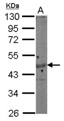 Western Blot: Actin Gamma 1 Antibody [NBP2-15258]