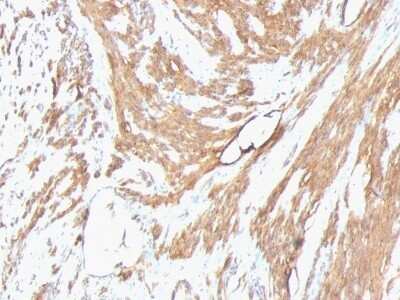 Immunohistochemistry-Paraffin: Actin (Muscle Specific) Antibody (HHF35 + MSA/953) [NBP2-45275]