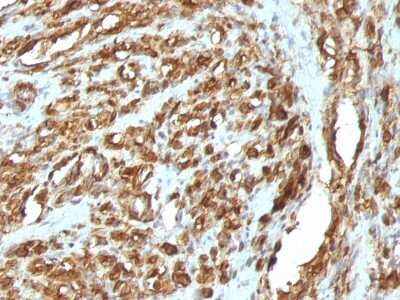 Immunohistochemistry-Paraffin: Actin (Muscle Specific) Antibody (HHF35 + MSA/953) [NBP2-45275]