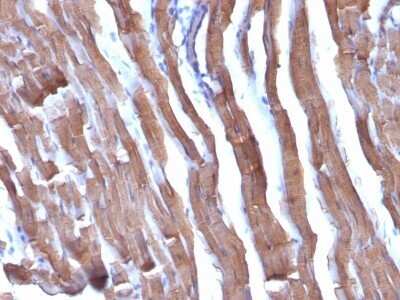 Immunohistochemistry-Paraffin: Actin (Muscle Specific) Antibody (HHF35 + MSA/953) [NBP2-45275]