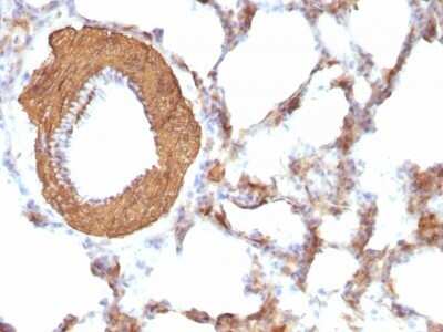 Immunohistochemistry-Paraffin: Actin (Muscle Specific) Antibody (HHF35 + MSA/953) [NBP2-45275]