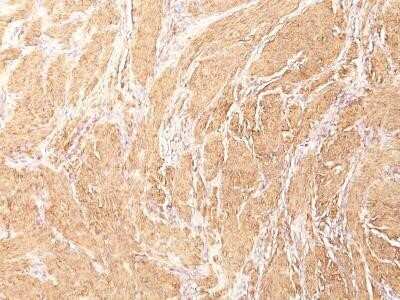 Immunohistochemistry-Paraffin: Actin (Muscle Specific) Antibody (HHF35) - Azide and BSA Free [NBP2-34634]