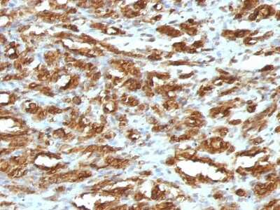 Immunohistochemistry-Paraffin: Actin (Muscle Specific) Antibody (HHF35) - Azide and BSA Free [NBP2-34634]
