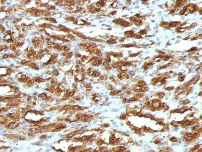 Immunohistochemistry-Paraffin: Actin (Muscle Specific) Antibody (HHF35) - IHC-Prediluted [NBP2-48154]