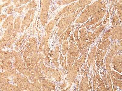 Immunohistochemistry-Paraffin: Actin (Muscle Specific) Antibody (HHF35) - IHC-Prediluted [NBP2-48154]