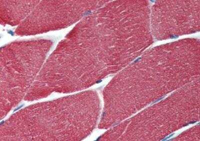 Immunohistochemistry-Paraffin: Actin (Muscle Specific) Antibody (HHF35) - BSA Free [NBP3-09165]