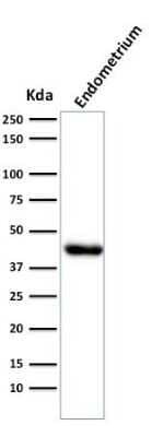 Western Blot: Actin (Muscle Specific) Antibody (HHF35) [NBP2-34230]